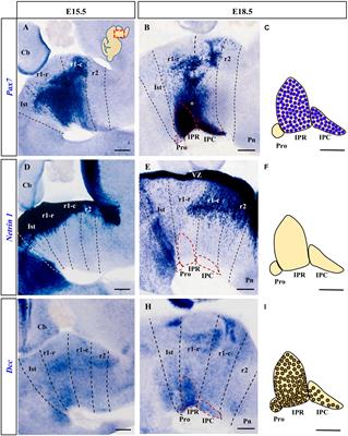 Netrin-1/DCC Signaling Differentially Regulates the Migration of Pax7, Nkx6.1, Irx2, Otp, and Otx2 Cell Populations in the Developing Interpeduncular Nucleus